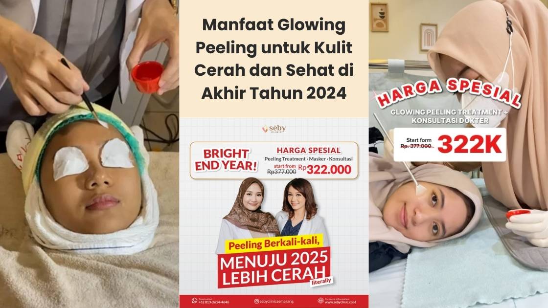 Wiwit Salon: Senyum Cerah, Kulit Sehat di Jantung Cilacap